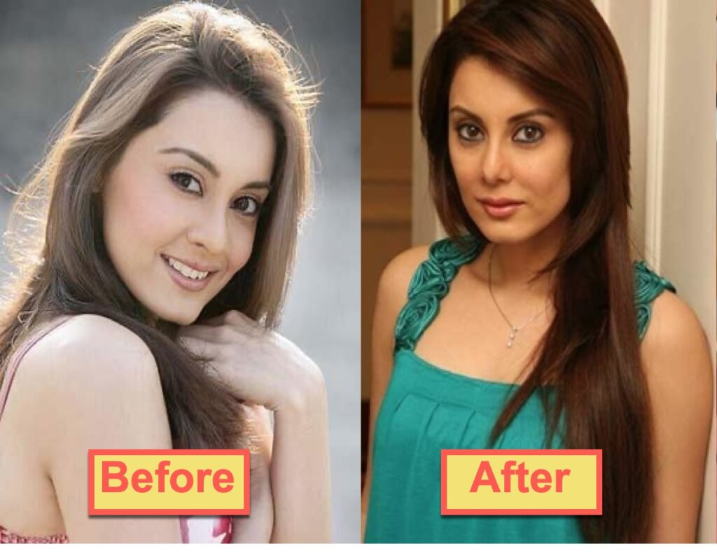 16 Bollywood Actresses Who Have Undergone Plastic Surgery 7 Minissha Lamba pre and post surgery pics - Wikibiotv.com