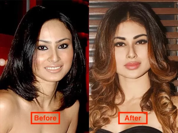 16 Bollywood Actresses Who Have Undergone Plastic Surgery 1 Mouni Roy before and after surgery pics