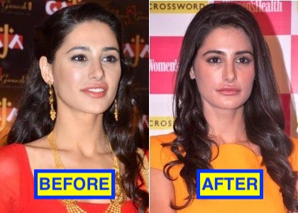 16 Bollywood Actresses Who Have Undergone Plastic Surgery 11 Nargis fakhri lips enhancement surgery before and after pics