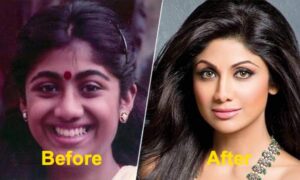 16 Actresses Who have Undergone Plastic Surgery - See Pics