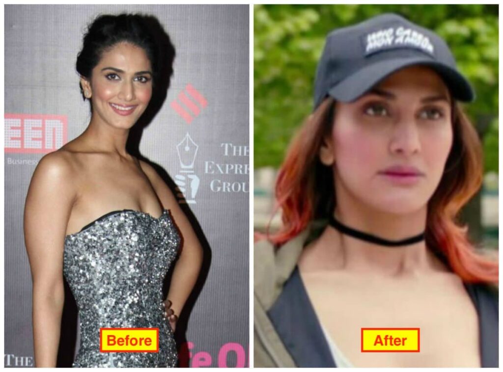 16 Bollywood Actresses Who Have Undergone Plastic Surgery 4 Vaani Kapoor before and after cosmetic surgery pics