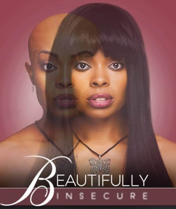 Beatifully insecure is film on Alopecia patient who loses her hair at the age of 9.