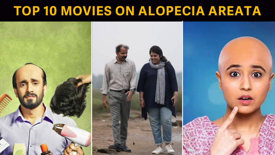 Top 10 movies on Alopecia Areata