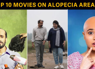 Top 10 movies on Alopecia Areata